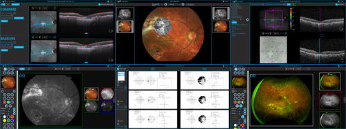 Software de análisis - AXIS™ - Sonomed Escalon - de gestión / de control / de hospital