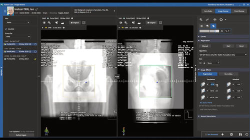 Software para imágenes médicas - MOSAIQ® 3 - Elekta - de oncología / de análisis de imágenes / de formación