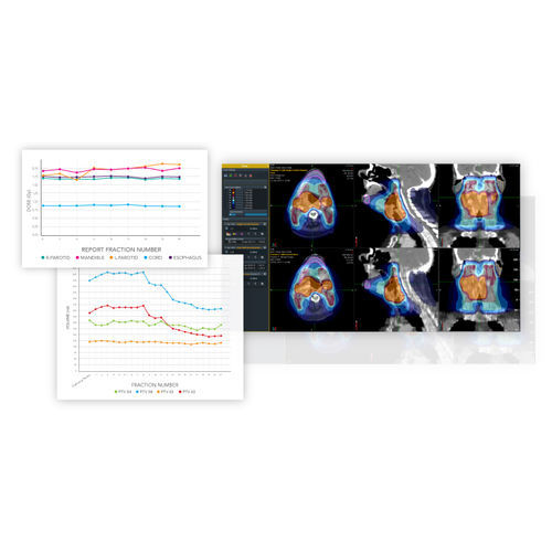 Software de radiología - PreciseART® - Accuray - análisis de datos / para informes / de planificación