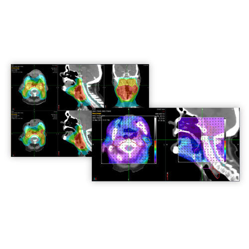 Software TDM - PreciseRTX® - Accuray - de gestión de las dosis absorbidas / de planificación de tratamiento / para tablet PC