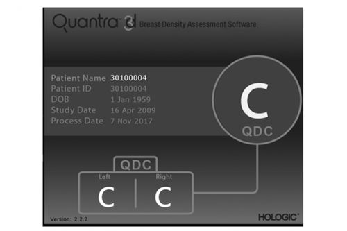 Software para mamografía - Quantra™ - Hologic - médico / para informes / de CAD