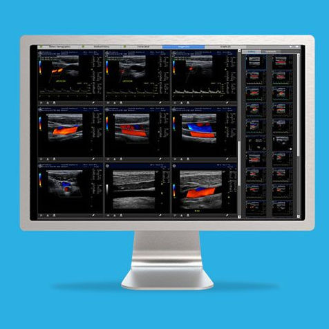 Software de visualización 3D - ViewPoint™ 6 - GE Healthcare - para informes / de medición / de postprocesamiento