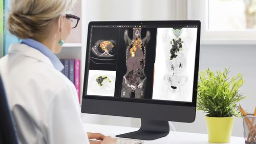 Software de tratamiento - MIM™ - GE Healthcare - de planificación / de planificación de tratamiento / médico