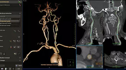 Software médico - IntelliSpace Portal 12 - Philips Healthcare - para imágenes médicas / para ortopedia / de oncología