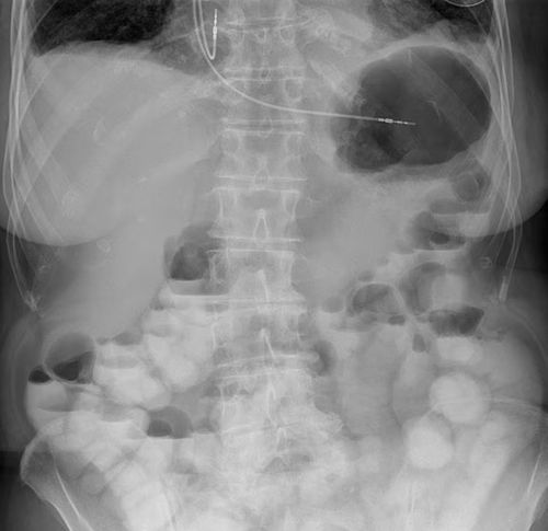 Software de visualización - UNIQUE 2 - Philips Healthcare - de diagnóstico / de monitorización de dosis de radiación / de planificación