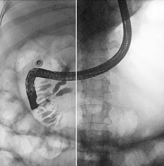 Software de mejora de la imagen - Dynamic UNIQUE - Philips Healthcare - de diagnóstico / médico / de radiografía