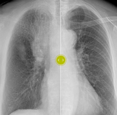 Software de mejora de la imagen - Philips Healthcare - médico / de radiografía / de hueso