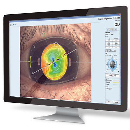 Software de planificación - EyeSuite IOL  - Haag-Streit Diagnostics - de medición / para cirugía oftalmológica / de anatomía