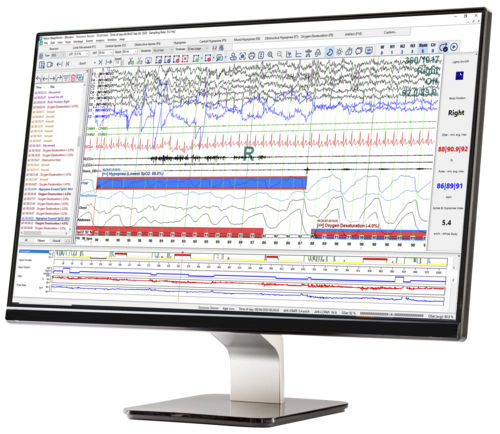 Software de análisis - SleepWorks™ - Natus Hearing & Balance - de gestión / para informes / de diagnóstico