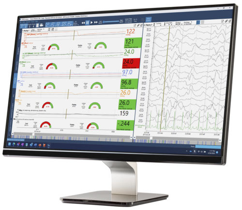 Software de análisis - Moberg CNS - Natus Hearing & Balance - de gestión / de monitorización / de tratamiento