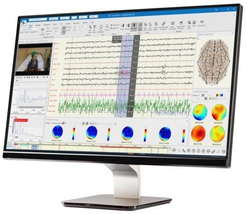 Sistema de gestión y análisis de visualización - BRAIN QUICK® - Natus Hearing & Balance - de archivo DICOM / de diagnóstico / de señales