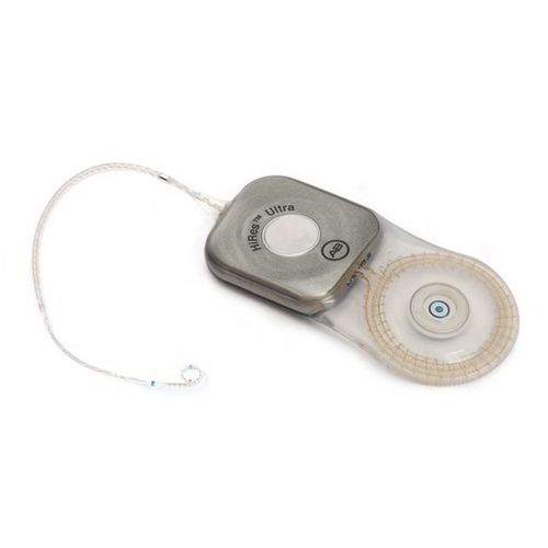 Implante coclear parte interna - HiRes™ Ultra - Advanced Bionics