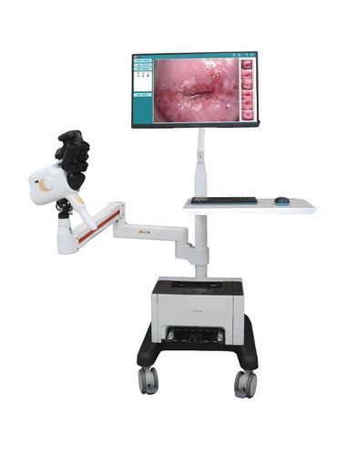 Colposcopio digital - V1-V2 - Guangzhou Sunray Medical Equipment Co., Ltd. - en carro