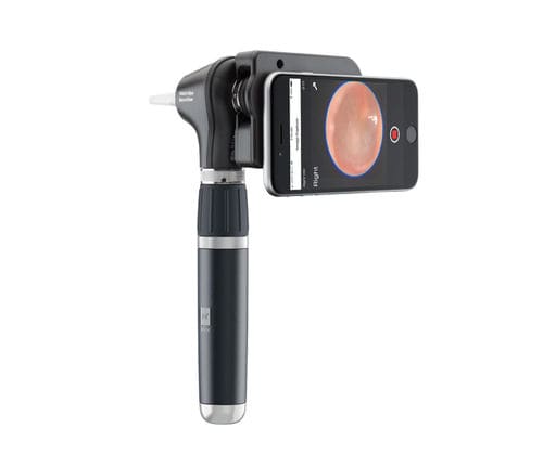 Otoscopio para adulto - MacroView® Plus - Welch Allyn - pediátrico / recto / con espéculo