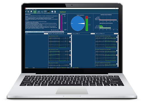 Software de detección - Lifescreen Pro - Spacelabs Healthcare - de análisis / de diagnóstico / de registro