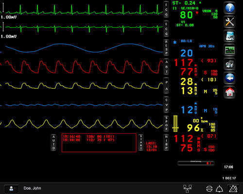 Software de monitorización - Spacelabs Healthcare - de medición / de alarma / de supervisión