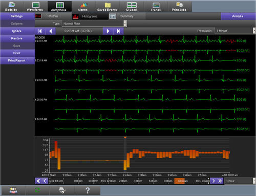 Software para ECG - Smart Disclosure - Spacelabs Healthcare - de visualización / de alarma / de sincronización horaria