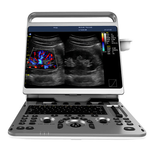 Ecógrafo portátil - Ebit 50 - CHISON Medical Technologies - para ecografía polivalente / doppler-color / blanco y negro