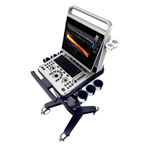 Ecógrafo portátil, con carro - EBit 30 - CHISON Medical Technologies - para ecografía polivalente / para ecografías abdominales y pélvicas / para ecografía urológica