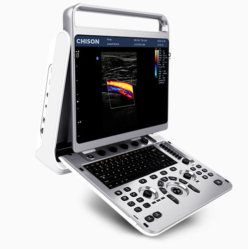 Ecógrafo portátil - EBit 20 - CHISON Medical Technologies - para ecografía polivalente / para ecografía ginecológica y obstétrica / para ecografías abdominales y pélvicas
