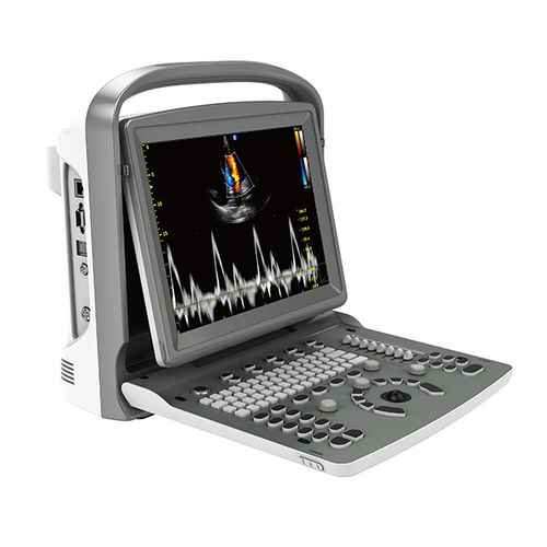 Ecógrafo portátil - ECO 6 - CHISON Medical Technologies - para ecografía polivalente / doppler-color / blanco y negro