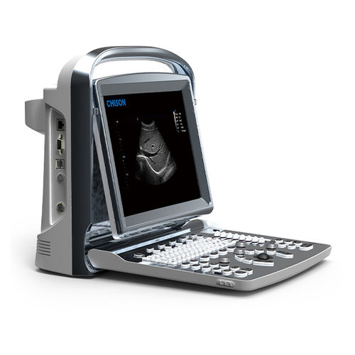 Ecógrafo portátil - ECO 1 - CHISON Medical Technologies - para ecografía polivalente / blanco y negro / consola integrada