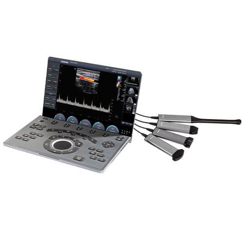 Ecógrafo portátil - SonoAir 30 - CHISON Medical Technologies - para ecografía polivalente / para ecografía ginecológica y obstétrica / para ecografía cardiovascular