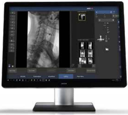 Software médico - MUSICA™ - AGFA - de radiografía / de angiografía / de visualización