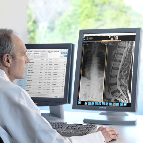PACS con computación en la nube - Xpert Suite&trade; - AGFA - para imágenes médicas / procesos basados en la web