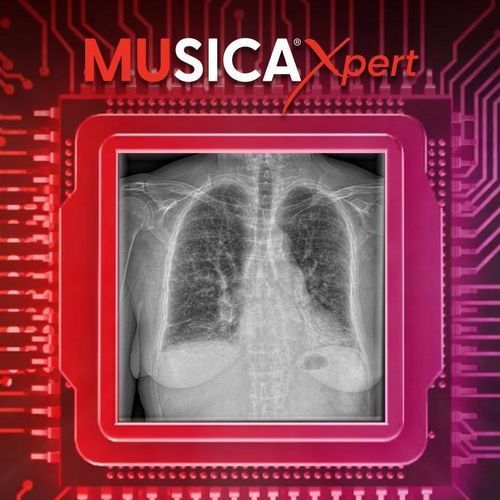 Sistema de postratamiento para el sector médico - MUSICA Xpert™ - AGFA
