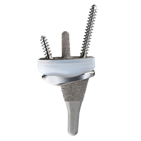 Prótesis de muñeca cementada - FREEDOM - Smith & Nephew