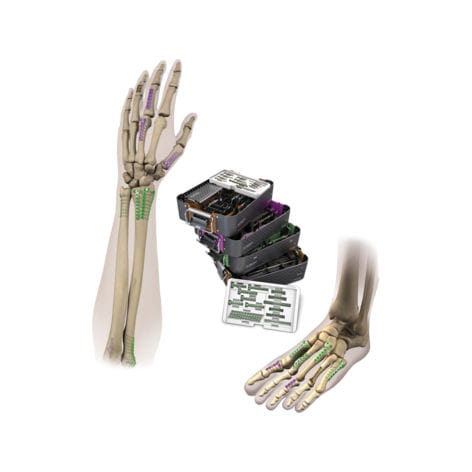 Placa de compresión para mano - VLP™ MINI-MOD™ - Smith & Nephew - para articulación metatarsofalángica / para muñeca / para tobillo
