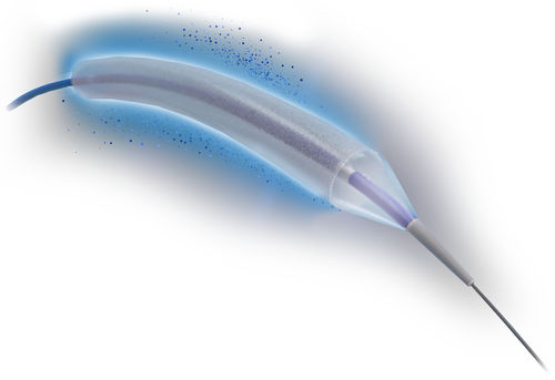 Catéter ACTP - SELUTION SLR™  - Cordis - coronario / con balón / de elución medicamentosa