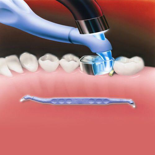 Polimerizador dental - Trimax™ - AdDent, Inc.  
