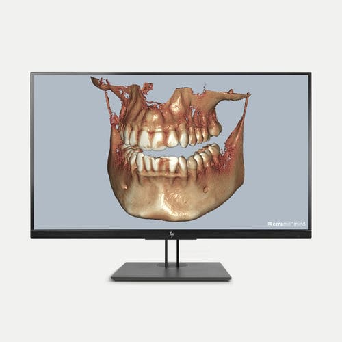 Módulo de software de visualización DICOM - Ceramill Dicom-Viewer - Amann Girrbach - de diagnóstico / de control / de CAD