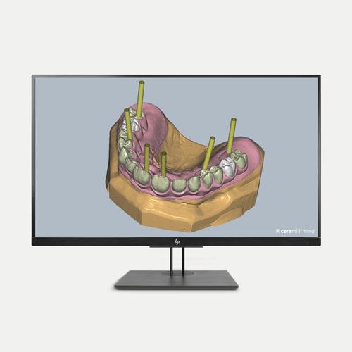 Módulo de software de CAD - Ceramill M-Gin - Amann Girrbach - de implantología dental