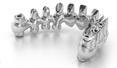 Puente dental - ANTHOGYR  