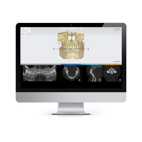 Software de planificación de tratamiento - Ortho Planner - 3shape - de análisis / de registro / de diseño