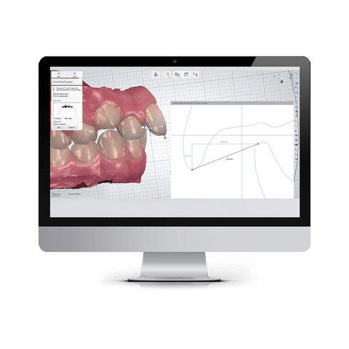 Software de análisis - ALIGNER STUDIO - 3shape - de gestión / de planificación de tratamiento / de tratamiento