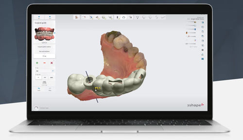 Software clínico - Implant Studio™ - 3shape - de implantología dental / para consultorios odontológicos / quirúrgico