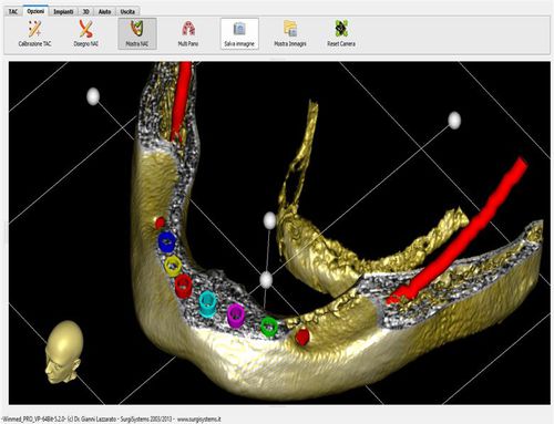 Software de visualización 3D - Winmed - ARTIGLIO SNC   - de planificación / quirúrgico / para imagen dental