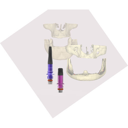 Implante dental cilíndrico - BTI Biotechnology Institute - de titanio / recto