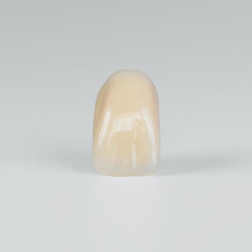 Prótesis dental de PMMA - PhysioStar NFC+ - Candulor - de los dientes anteriores / para dientes posteriores / translúcida