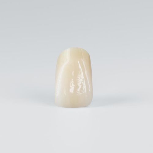 Prótesis dental de PMMA - PhysioSelect TCR  - Candulor - de resina / incisivos inferiores / incisivos superiores