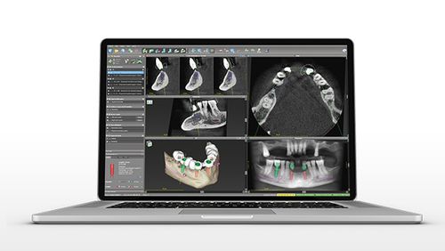 Software para cirugía dental - coDiagnostiX - Dental Wings   - para odontología / de implantología dental / de planificación