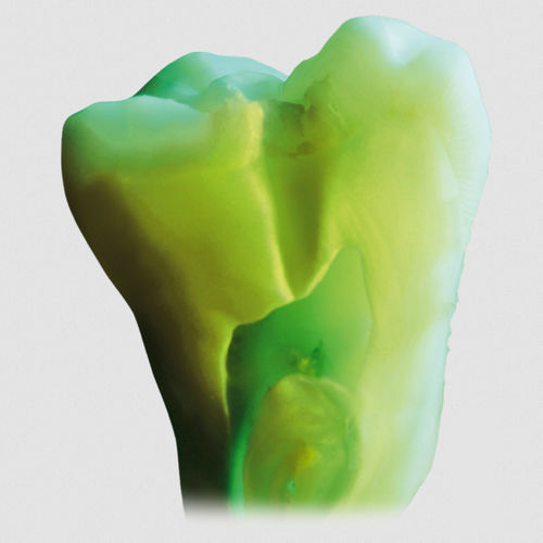 Material dental de cerámica - ceraMotion® Zr - DENTAURUM - para estratificación de cerámica / pasta / transparente