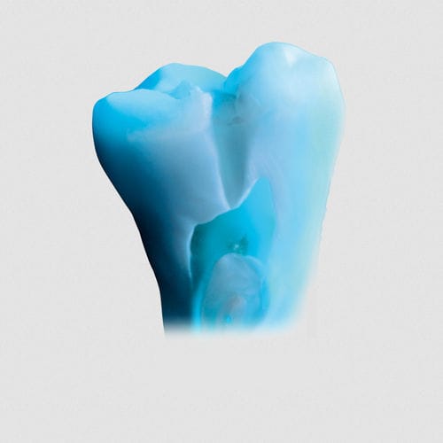 Material dental de cerámica - ceraMotion® Ti - DENTAURUM - para estratificación de cerámica / translúcido