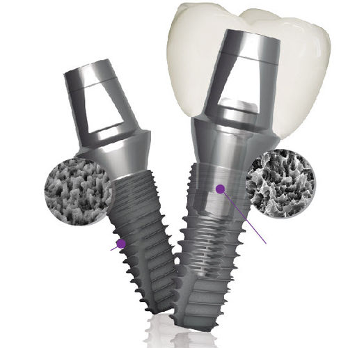 Implante dental cónico - Implantium II  - Dentium - de titanio / hexágono interno