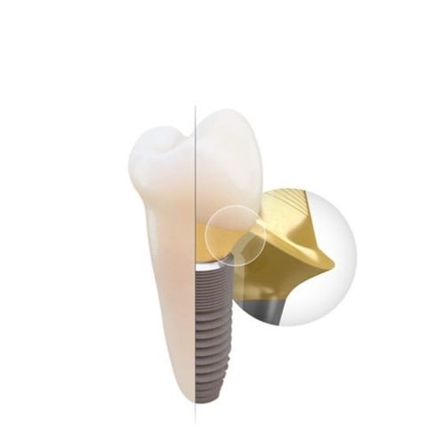Pilar para implante de titanio - Atlantis&reg; - DENTSPLY Implants GmbH - externo / recto / en ángulo