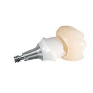 Pilar para implante de titanio - ANKYLOS® TitaniumBase - DENTSPLY Implants GmbH - interno / recto